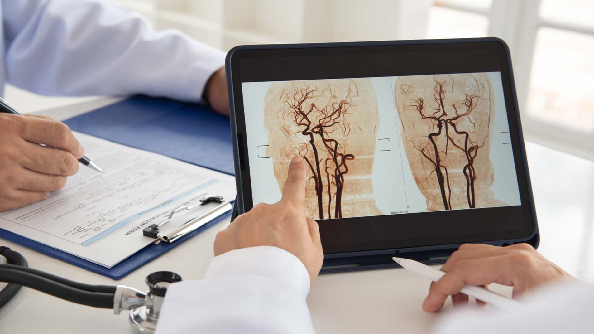 Recuperarea după AVC: Cum începe și ce factori influențează progresul